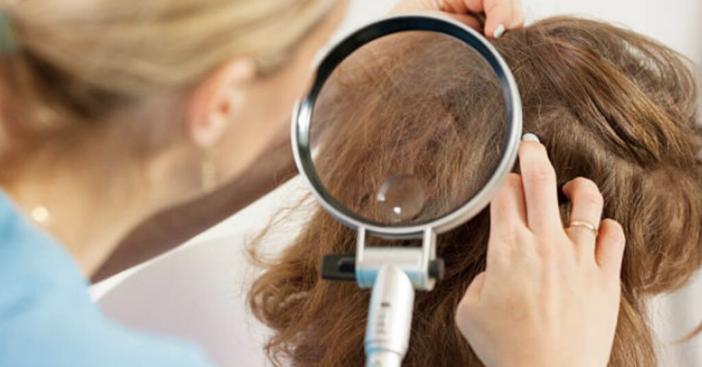Post-Treatment Care For Your Scalp