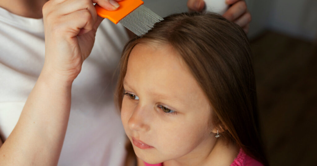 The Environmental Impact of Lice Treatment: Sustainable Solutions for a Common Problem