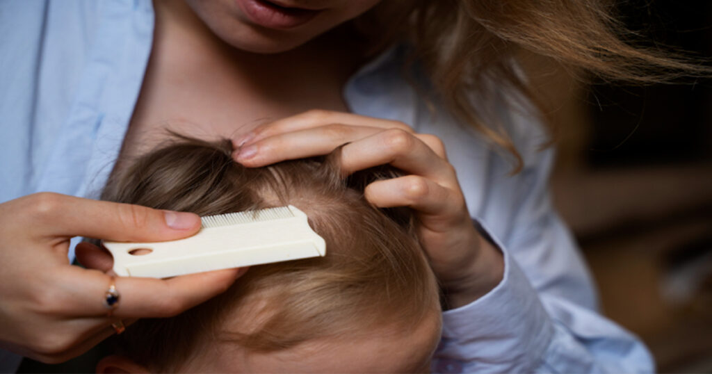 How Does Getting Lice Mentally Disturb You?