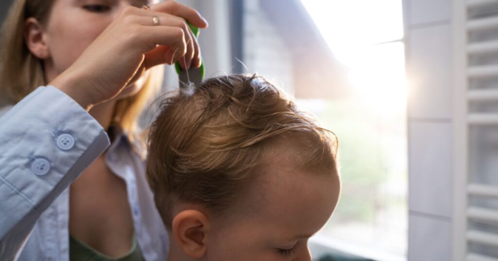 Is Head Lice More Common In The Summer?