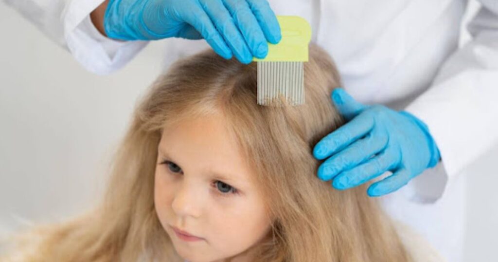Different Stages of Lice Growth and Their Feeding Habits