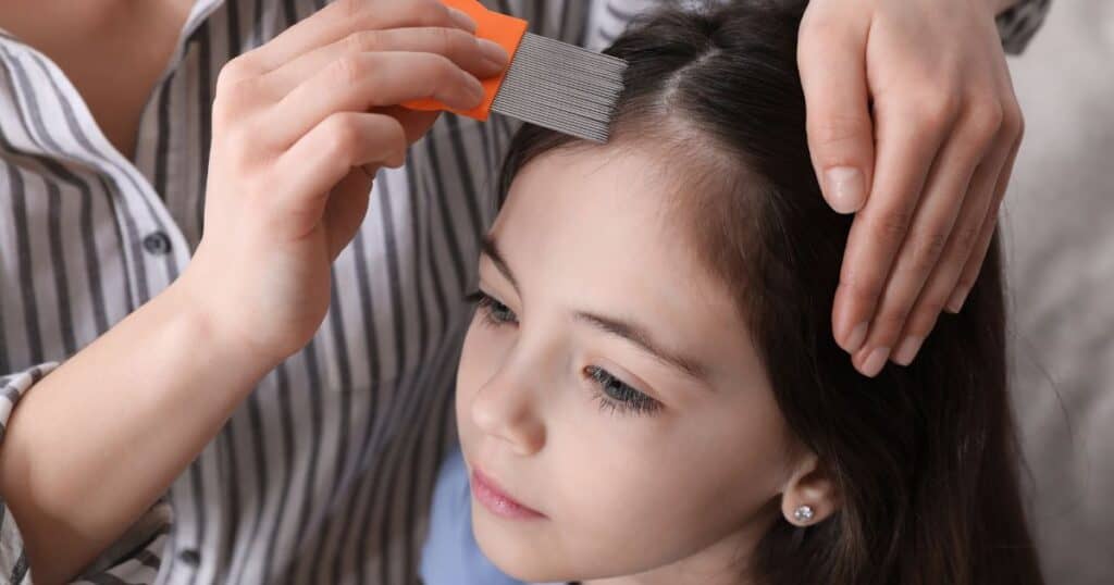 safe lice treatment