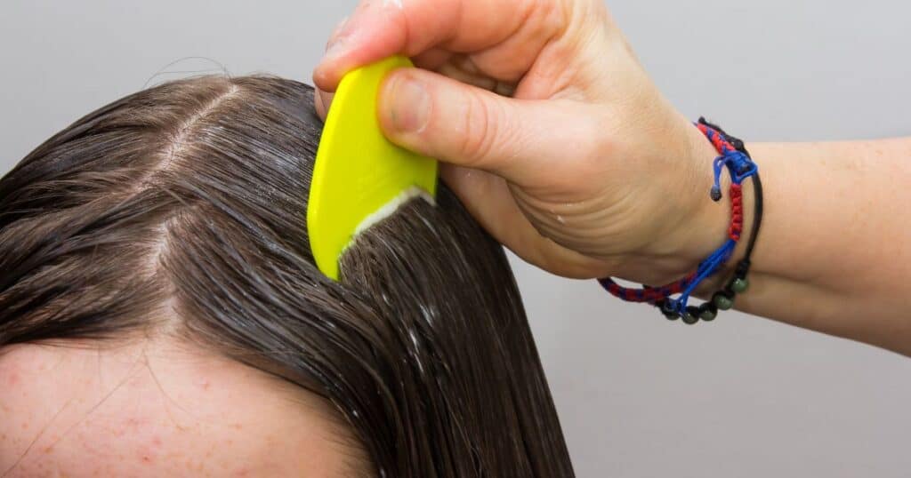 Will lice treatment ruin hair color