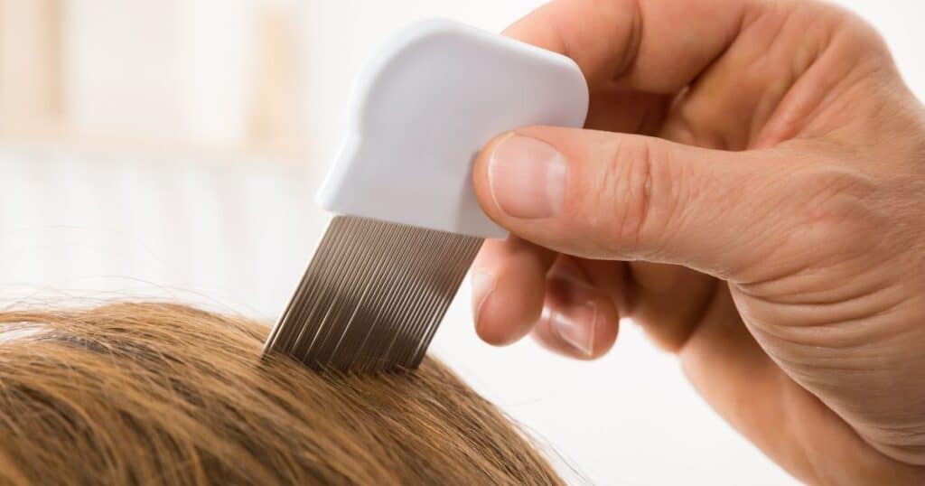 Will lice go away without treatment