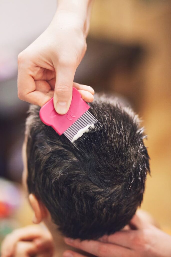 spotting lice in kids